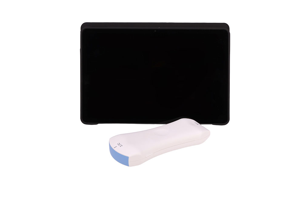 Diagnostic Probe (Handheld Probe with AI)